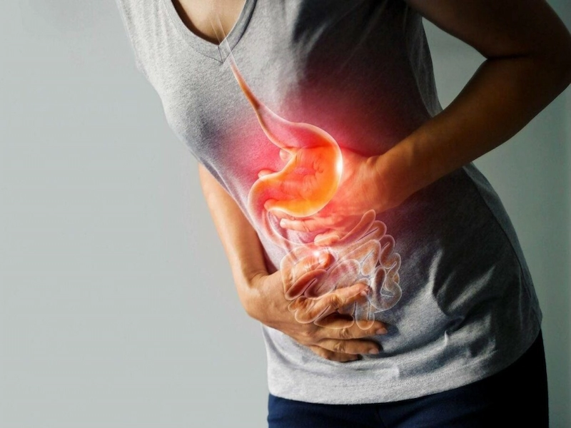 علل اصلی رفلاکس معده در ایران بررسی شد