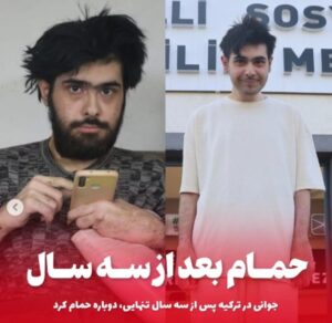 ماجرای جوان ترکیهای که سه سال حمام نرفت و همه را شوکه کرد جوان